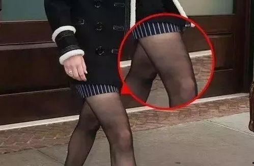 丝袜脚受伤漫画,一场意外的“美丽”代价